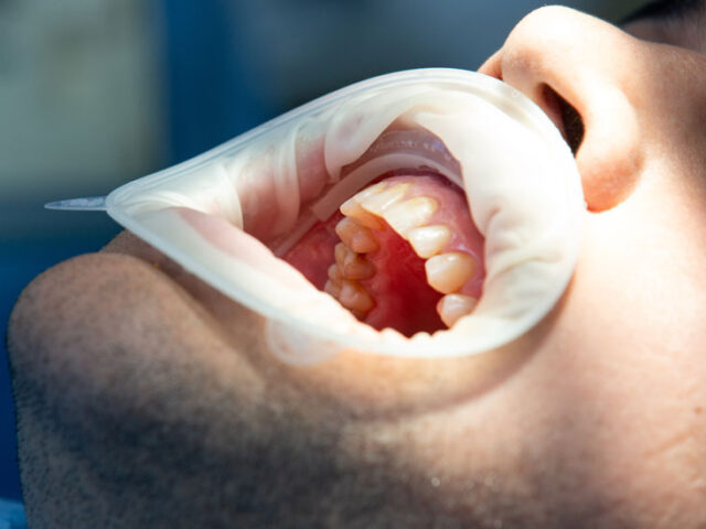 https://www.dentistagenzano.it/wp-content/uploads/2026/02/Parodontologia-odontoiatra-genzano-di-roma-640x480.jpg
