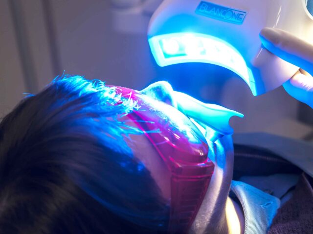 Sbiancamento Denti: Costi, Durata e Risultati