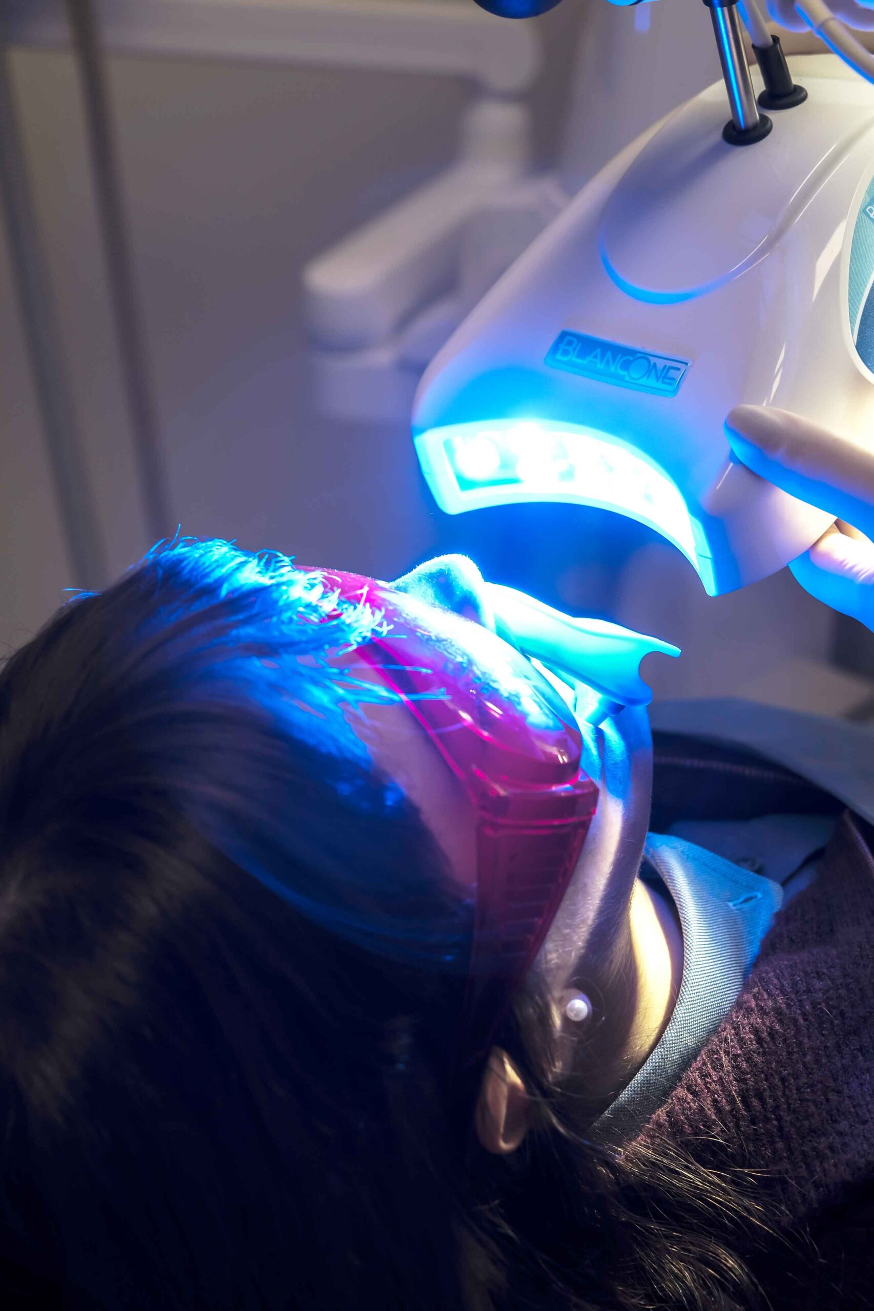 https://www.dentistagenzano.it/wp-content/uploads/2026/05/Sbiasncamento-dentale-professionale-rudina-rustemaj-genzano-di-roma-castelli-romani-scaled.jpg