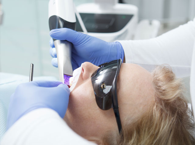 Impronta Digitale Dentale